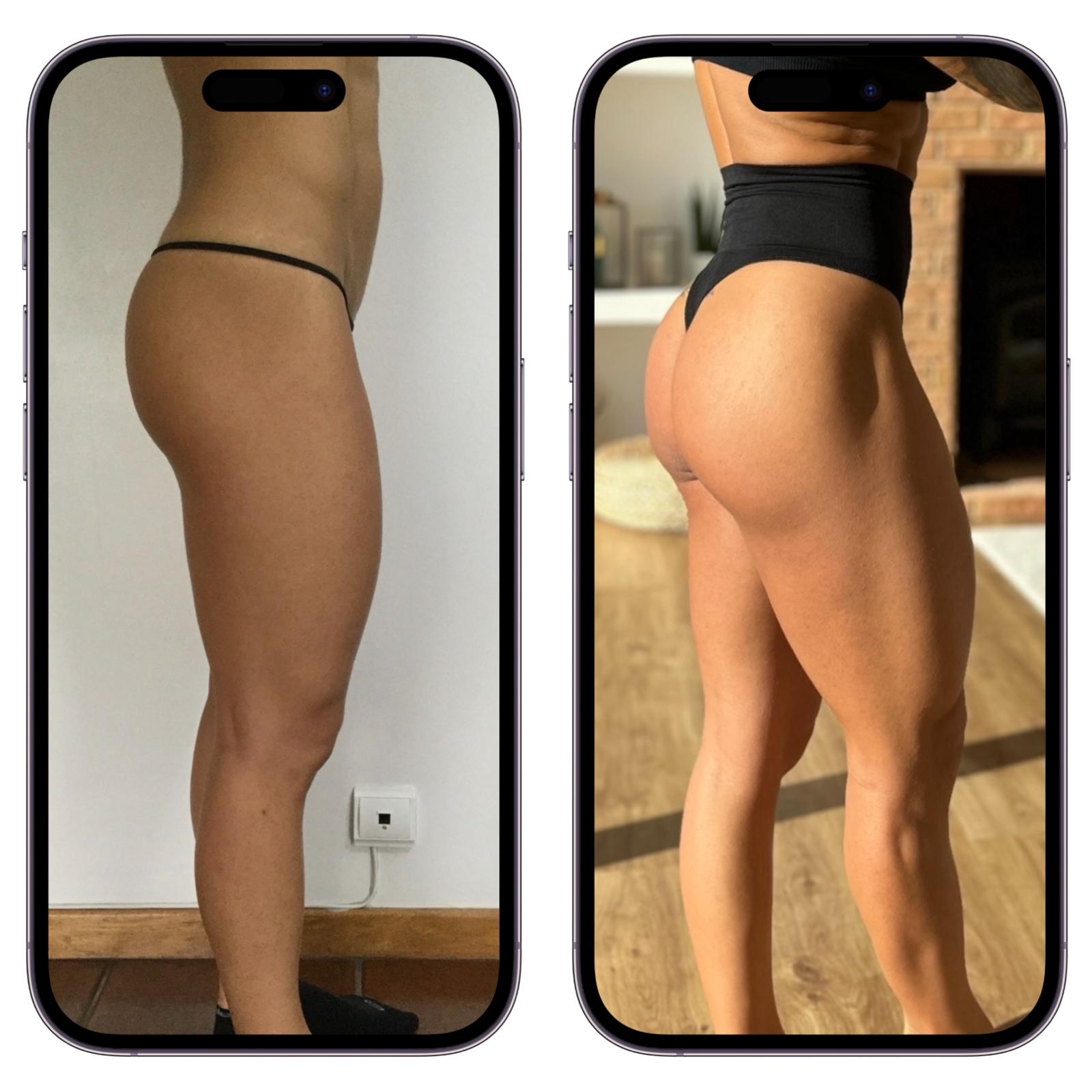 Antes e Depois