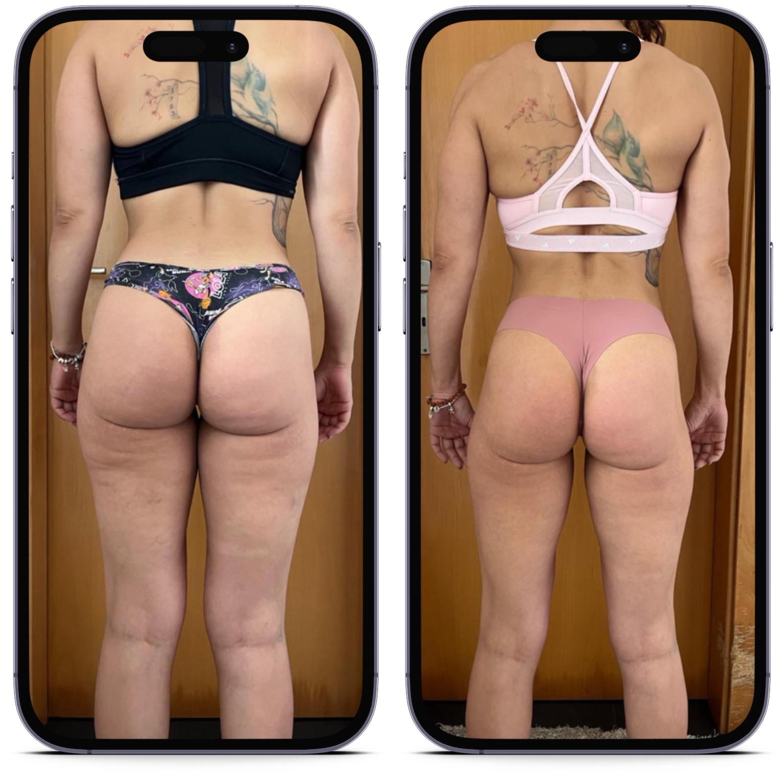 Antes e Depois