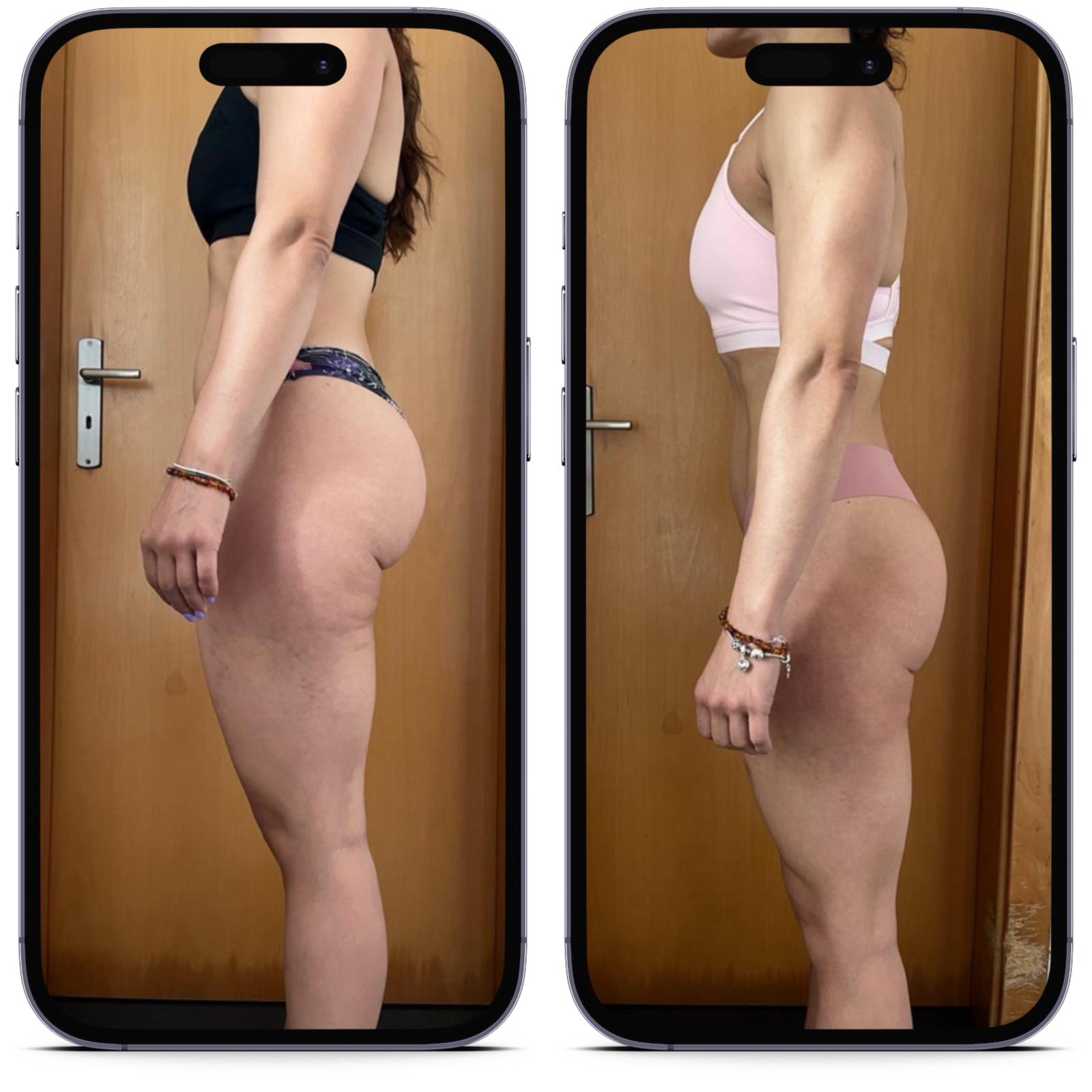 Antes e Depois