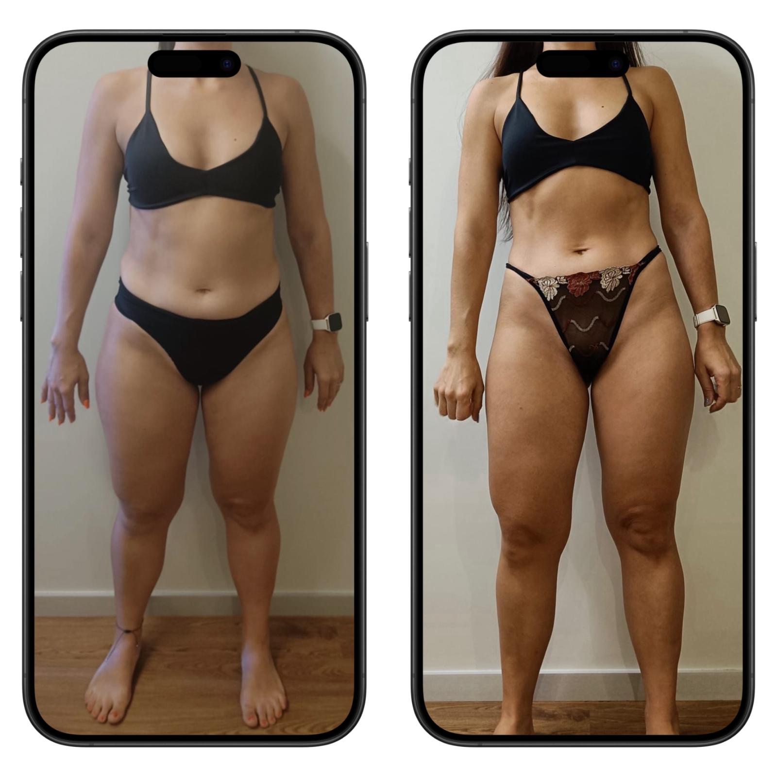 Antes e Depois
